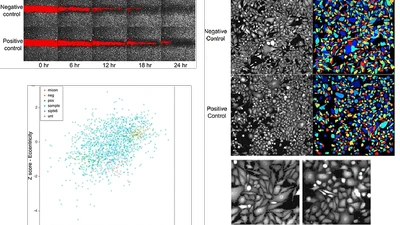 Transcriptomic and Functional Screens Reveal MicroRNAs That Modulate Prostate Cancer Metastasis featured image
